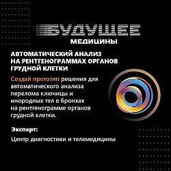Представители РТУ МИРЭА стали первыми на хакатоне в треке от Центра диагностики и телемедицины ДЗМ 